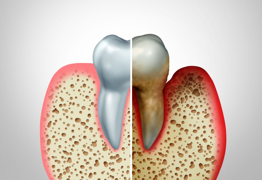 Periodontist Near Me