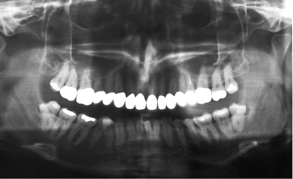 20602 Periodontist