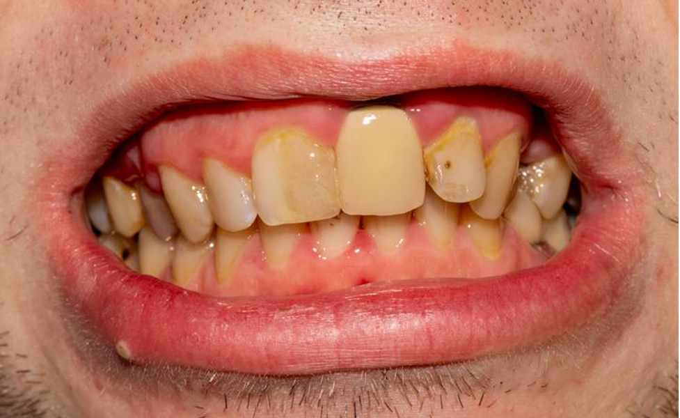 Alexandria VA Periodontist