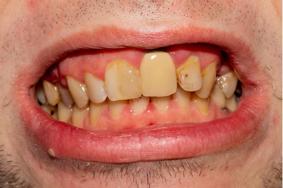 Alexandria VA Periodontist
