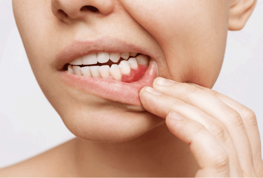 Gum Specialist Alexandria" "Periodontist Alexandria VA